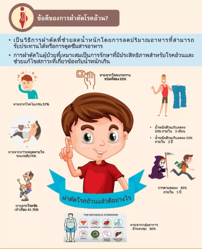 ภาพข้อดีของการผ่าตัดโรคอ้วน